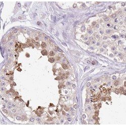 Mitotic Arrest Deficient 2 Like 1 (MAD2L1) Antibody