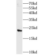 WB analysis of HEK-293 cells, using MAD2L1 antibody (1/1000 dilution).