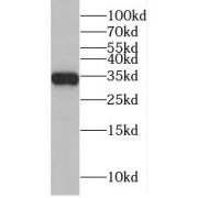 WB analysis of HeLa cells, using MAD2L1BP antibody (1/800 dilution).