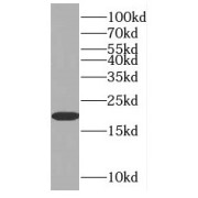 WB analysis of human lung tissue, using MAFF antibody (1/300 dilution).