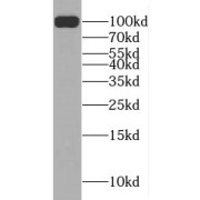 WB analysis of mouse spinal cord tissue, using MAG antibody (1/2500 dilution).