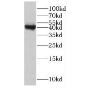 WB analysis of A375 cells, using MAGEA1 antibody (1/500 dilution).