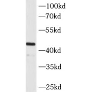 WB analysis of mouse brain tissue, using MAGEA3 antibody (1/2000 dilution).