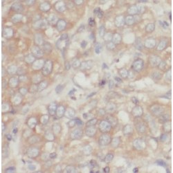 Melanoma-Associated Antigen 4 (MAGEA4) Antibody