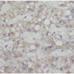 Melanoma-Associated Antigen C3 (MAGEC3) Antibody