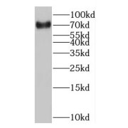 WB analysis of A375 cells, using MAGEC3 antibody (1/600 dilution).