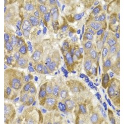 Melanoma-Associated Antigen D1 (MAGED1) Antibody