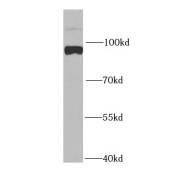 WB analysis of A549 cells, using MAGED1 antibody (1/1000 dilution).