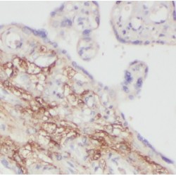 Melanoma-Associated Antigen D1 (MAGED1) Antibody