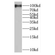 WB analysis of A549 cells, using MAGED1 antibody (1/1000 dilution).