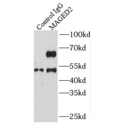 Melanoma-Associated Antigen D2 (MAGED2) Antibody