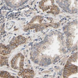 MAGE Family Member H1 (MAGEH1) Antibody