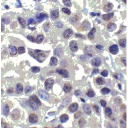 Mucosa-Associated Lymphoid Tissue Lymphoma Translocation Protein 1 (MALT1) Antibody