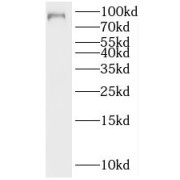 WB analysis of HeLa cells, using MALT1 antibody (1/600 dilution).