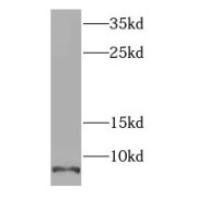 WB analysis of MCF-7 cells, using SCGB2A2 antibody (1/300 dilution).