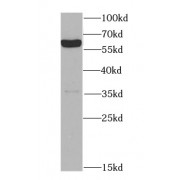 WB analysis of human placenta tissue, using MAOA antibody (1/1000 dilution).