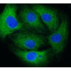 Microtubule Associated Protein Light Chain 1B (MAP1B) Antibody