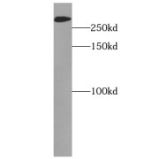 WB analysis of mouse cerebellum tissue, using MAP1B antibody (1/500 dilution).