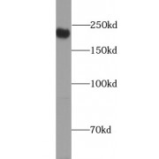 WB analysis of HEK-293 cells, using MAP4 antibody (1/600 dilution).