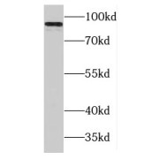 WB analysis of Raji cells, using MAP4K1 antibody (1/1000 dilution).