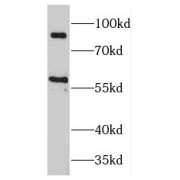 WB analysis of mouse brain tissue, using MAP4K2 antibody (1/300 dilution).