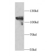 WB analysis of human skeletal muscle tissue, using MAP4K3 antibody (1/1000 dilution).