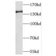 WB analysis of human skeletal muscle tissue, using MAP4K4 antibody (1/1000 dilution).