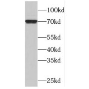 WB analysis of SKOV-3 cells, using MAPK7 antibody (1/600 dilution).