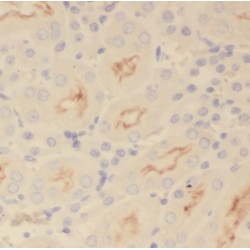 Target Of Rapamycin Complex 2 Subunit MAPKAP1 (MAPKAP1) Antibody