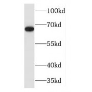 WB analysis of mouse kidney tissue, using MAPKAP1 antibody (1/500 dilution).