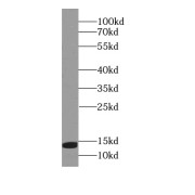 WB analysis of human liver tissue, using MAPKSP1 antibody (1/500 dilution).