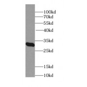 WB analysis of HeLa cells, using MARCH5 antibody (1/500 dilution).