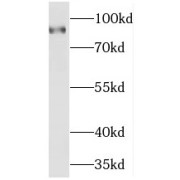 WB analysis of mouse brain tissue, using Marcks antibody (1/2000 dilution).