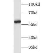 WB analysis of mouse brain tissue, using Marcksl1 antibody (1/500 dilution).