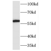 WB analysis of mouse brain tissue, using Marcksl1 antibody (1/500 dilution).