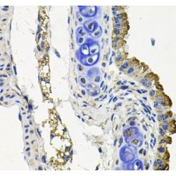 Serine/Threonine-Protein Kinase MARK1 (MARK1) Antibody