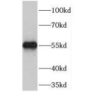 WB analysis of HeLa cells, using MASP1 antibody (1/300 dilution).