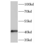 Serpin B5 (SERPINB5) Antibody