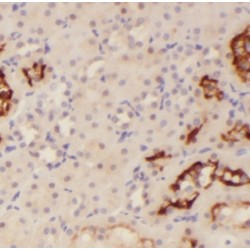 Microtubule Associated Serine/Threonine Kinase 3 (MAST3) Antibody