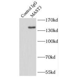 Microtubule Associated Serine/Threonine Kinase 3 (MAST3) Antibody