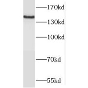 WB analysis of Jurkat cells, using MAST3 antibody (1/500 dilution).