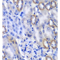 Megakaryocyte Associated Tyrosine Kinase (MATK) Antibody