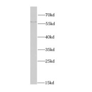 WB analysis of K-562 cells, using MATK antibody (1/1000 dilution).