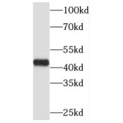 WB analysis of Jurkat cells, using MBD2 antibody (1/1000 dilution).