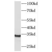 WB analysis of Y79 cells, using MBD3 antibody (1/600 dilution).