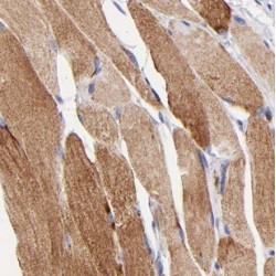 Muscleblind Like Splicing Regulator 3 (MBNL3) Antibody