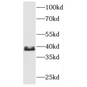 WB analysis of mouse skeletal muscle tissue, using MBNL3 antibody (1/600 dilution).