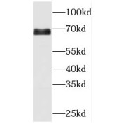 WB analysis of Jurkat cells, using MBTD1 antibody (1/600 dilution).