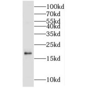 WB analysis of human heart tissue, using MCEE antibody (1/400 dilution).