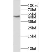WB analysis of SH-SY5Y cells, using MCHR1 antibody (1/1000 dilution).